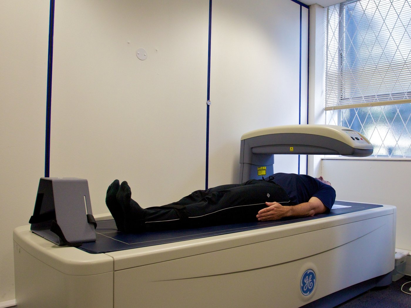 Paziente disteso sul lettino durante una scansione DEXA, con il braccio dello scanner posizionato sopra il corpo